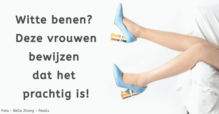 Evendelen.be Witte benen
